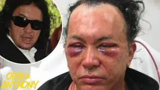 Opie & Anthony: Gene Simmons, Facelift Phoner (03/28/07)