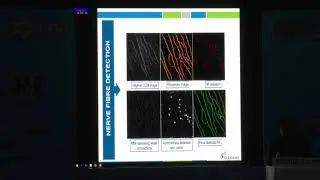 AIOC2019 FP453 Cornea III Analysis of Confocal Microscopy Using A Novel Software in Healthy..