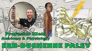 Erb-Duchenne Palsy Explained