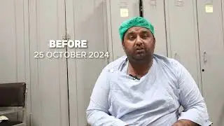 117 Kg to 82 Kg with Weight Loss Surgery | Bariatric Surgery Success Story | Dr Shehryar Niazi