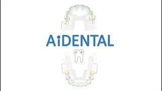 A.I Powered RPD Designer and Game - AiDENTAL (Free / Online)