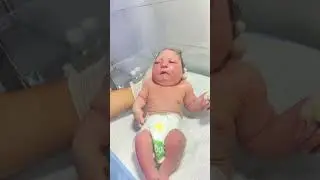 Down Syndrome and Microcephalic Baby in NICU | Admitted for Nursing Care & NICU Protocol #neonatal