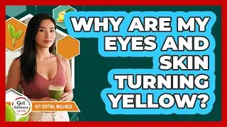 Why Are My Eyes And Skin Turning Yellow?