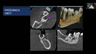 I. R&oacute;żyło-Kalinowska - Radiologia stomatologiczna cz. 1