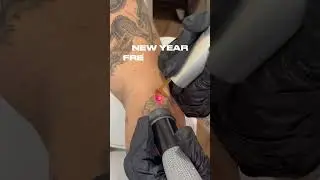 New year, fresh start: Laser tattoo removal edition #tattoo #lasertattooremoval #lasertattooremoval