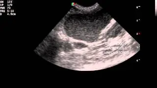 Linfoma felino ecografia