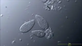 Small Marine Ciliates (ciliophora) - Structure: cilia, macronucleus, vacuoles (DIC microscopy) (4K)