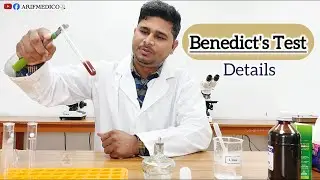 Benedict's Test || Principle,Procedure and result || Benedict's Bangla #benedicttest