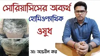 Psoriasis Best Homoeopathic medicine ।।সোরিয়াসিসের বেস্ট হোমিওপ্যাথিক ওষুধ।।
