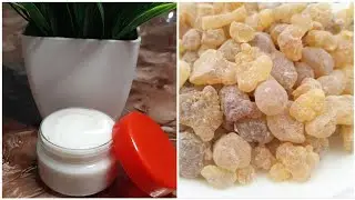 #لباناالذكرللوجه#Luubanta Ka Samayso cream Wejiga 7 Malin Ayad Isku badalaysa😱😱{2020}