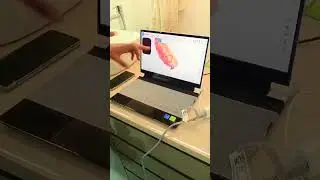 #goeldentalclinic #fullmouth #intraoral #scanner3d #bestdental #technology #rohini #9013574663