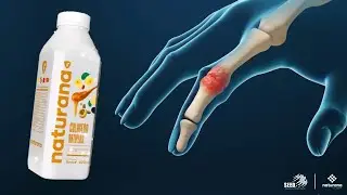 Col&aacute;geno Artiplus para Dolor de Huesos y Articulaciones