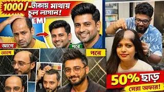 ফাঁকা মাথায় চুল লাগান 😱|Best Hair Patch Centre in Kolkata|No Surgery Hair Fixing|Permanent hair2026
