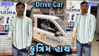 કુત્રિમ હાથ Machanical Hand #artificiallimbcenter #artificialhand #prosthesis #hospital #gujarat