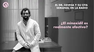 &iquest;El minoxidil es realmente efectivo? | Cl&iacute;nica Devesa