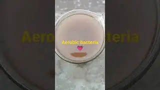 Wastewater treatment plant/#aerobicbioculture/#ytshorts/#shorts/#sumitstudytalks.