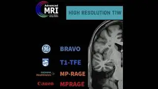 High resolution T1 imaging3D MP-RAGE using 32 channel head coil