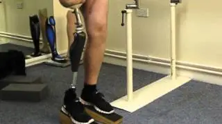 Introducing the Genium Microprocessor Controlled Knee