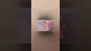 Kid Named Finger Vs Howard Hamlin
