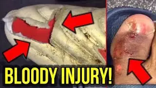 FIKAYO TOMORI INJURY! - ARE THE LATEST ADIDAS FOOTBALL BOOTS SAFE?