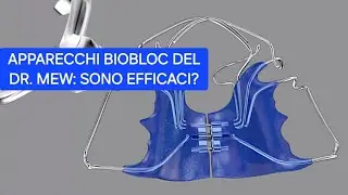 apparecchi ortodontici biobloc : sono efficaci? episodio 2