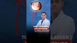 LIVE TURBT Surgery | Bladder Tumor Removal by Dr. Dheeraj Shamsukha | Kuber Hospital Delhi