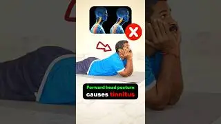 Forward head & neck posture causes tinnitus | Dr. SRK | energy clinic | #physiotherapy #reels