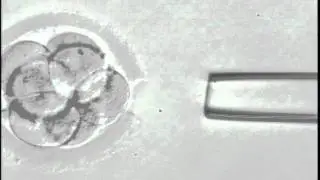 Embryo Biopsy | Nashville Fertility Center