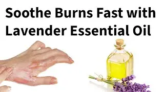 🔥 Natural Remedies for Minor Burns | Honey, Aloe Vera & Spike Lavender Essential Oil 🌿