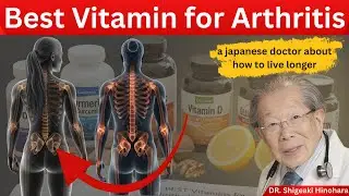 The BEST Vitamins for Arthritis, Joint Pain and Chronic Inflammation  (Japanese oldest doctor)
