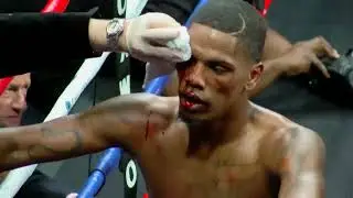 Derrick Whitley Jr  vs Sharad Collier