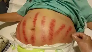 Ngerokin  Perut untuk ngilangin Masuk Angin