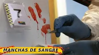 Clasificación de manchas de S4nGr3  | Hematología Forense