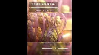FaceTite