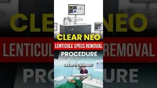 Clear Neo Lenticule Surgery &ndash; Painless Specs Removal || Surgery Procedure
