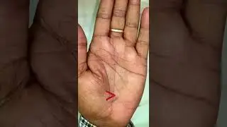 Lottery line#lottery #shorts #ytshorts #palmistry #hastrekha #astrology #astro -Arup