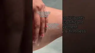 You won't believe your results with this product 👀 #shortsviral #skincare #bodycare