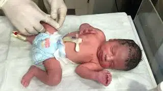 Newborn Baby Received from Labour Room: Initial Assessment & RBS Check in NICU 