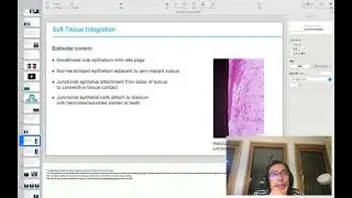 上浦歯科　研修医ゼミ2025   Tissue Integration of Dental Implants　2