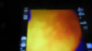 Watercooker Convection Patterns Thermal View