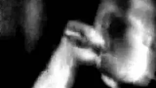 Restiform Bodies - 