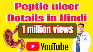 Peptic Ulcer Disease in Hindi | Types, Causes, Symptoms And Management of Peptic Ulcer