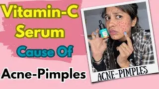 क्यों Vitamin - C Serum से  Acne - Pimples होते हैँ  | Vitamin C Serum Se Acne - Pimple Kyu Hote H |