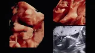 The fetal skeletal system