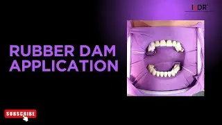 Rubber Dam Application