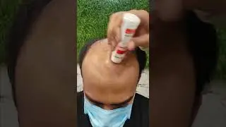 Long Hair Look in Hair Patch | long hair patch #shorts #youtubeshorts