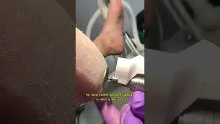 Пылесос для педикюра nail-assistant