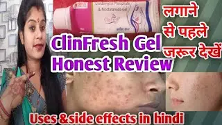 ClinFresh Gel | ClinFresh gel Uses & Side effects in hindi | ClinFresh Gel Honest Review in hindi ||