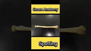Anatomy Spotting #1styearmbbslectures #medicine #anatomy