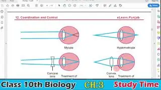 10th Class BIOLOGY, Chapter 12 (COORDINATION ): LECTURE 9: DISORDERS OF EYE